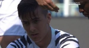 infortunati juventus dybala pescara