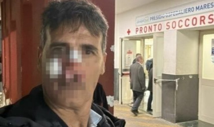 Il presidente della Puteolana Gennaro Esposito dopo l'aggressione